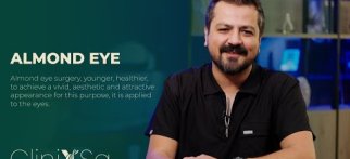 Almond Eye (Fox Eyes) • Dr. Sinan Akyürek