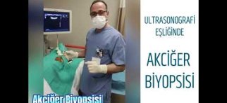 ULTRASONOGRAFİ EŞLİĞİNDE AKCİĞER BİYOPSİSİ