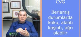 CVG (Cutis Verticis Gyrata) Hastalığı
