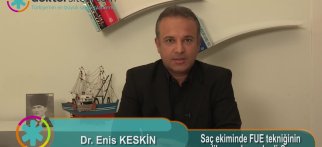 Saç ekiminde FUE tekniğinin endikasyonları nelerdir?