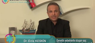 Genetik sebeblerle oluşan saç dökülmelerinde ne yapmak gerekir?