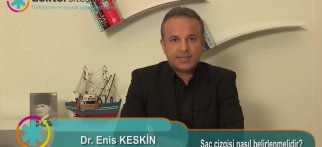 Saç çizgisi nasıl belirlenmelidir?