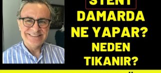STENT DAMARDA NE YAPAR?