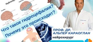 Что такое гидроцефалия? Почему это происходит? | Проф. Др. Альпер КАРАОГЛАН