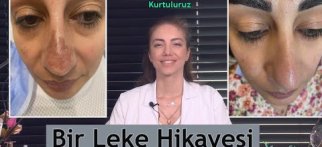 Bir " Leke " Hikayesi
