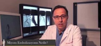 MİYOM EMBOLİZASYONU NEDİR?
