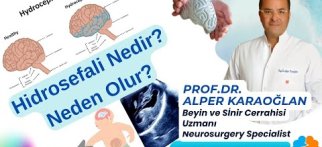 HİDROSEFALİ Hastalığı Nedir? Neden Olur? | Prof.Dr. Alper KARAOĞLAN