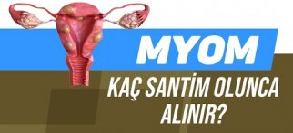 Miyom Nedir? Miyomlar Neden Olur? Myom Tedavi Seçenekleri Nelerdir?