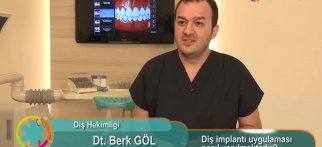 Diş implantı uygulaması nasıl yapılmaktadır?