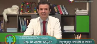 Kurdeşen (ürtiker) belirtileri nelerdir?