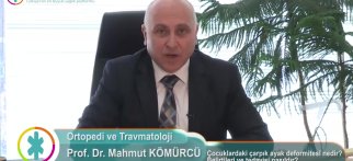 Çocuklardaki çarpık ayak deformitesi nedir? Belirtileri ve tedavisi nasıldır?
