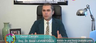 Botoks ile anal fissür (makatta yırtık) nasıl tedavi ediliyor?