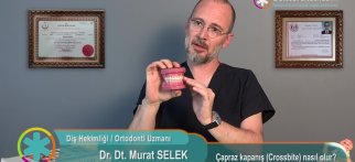Çapraz kapanış (Crossbite) nasıl olur?