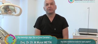 Diş kökü kistlerinin tedavisi nasıl yapılır? İyileşme dönemi nasıldır?
