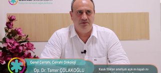 Kasık fıtıkları ameliyatı açık mı kapalı mı (laparoskopik) yapılmalıdır?