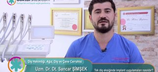 Tek diş eksiğinde implant uygulamaları nasıldır?