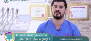 Diş köklerinde oluşan kistlerin tanı ve tedavisi nasıldır?