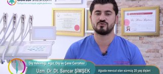 Ağızda mevcut olan sürmüş 20 yaş dişleri her zaman çekilmeli midir?
