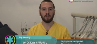 Diş implantı nasıl yapılır? Süreç çok uzun mudur?