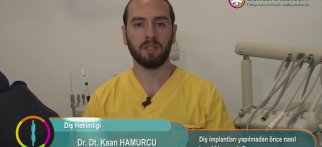Diş implantı yapılmadan önce nasıl hazırlık yapılır?