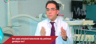 Her yaşta ortodonti tedavisinde diş çekilmesi gerekiyor mu?