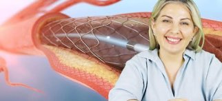 Koroner Arter Hastalığı Nedir? Nasıl Tedavi Edilir? | Uzm. Dr. Jamila Pirmammadova
