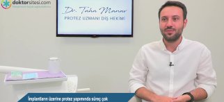 İmplantların üzerine protez yapımında süreç çok uzun mudur? İmplantların kullanım süresi ne kadardır?