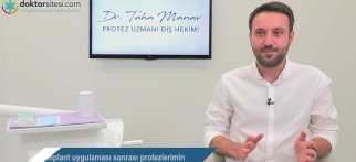 İmplant uygulaması sonrası protezlerimin yapımı için çok beklemek gerekir mi?