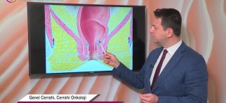 Hemoroidal hastalıklar nedir? Tedavisi nasıldır?