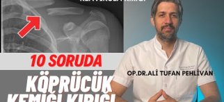 Köprücük Kemiği Kırığı (Klavikula Kırıkları)// Köprücük Kemiğin Kırığı Nasıl Tedavi Edilir?