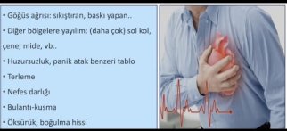 Yapay Zeka Desteği (Cardisio) ile Kalp Krizi Riskini Öngörmemiz Mümkün mü? Cevabı Yeni Videomuzda..