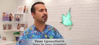 Vaser Liposuction Sonucu Ne Zaman Ortaya Çıkar?