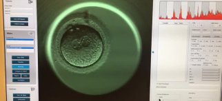Embriyoların gelişiminde embriyoskop