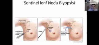 Youtube – Sentinel Lenf Nodu ve Aksiler Lenf Nodları