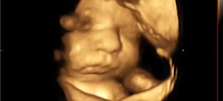 Youtube – 4 boyutlu ultrasonda gülümseyen bebek
