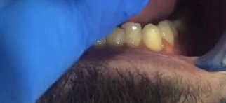 Youtube - Sağlıklı beyaz dişler