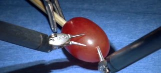Youtube - Da Vinci robotik cerrahi üzüm ameliyatı