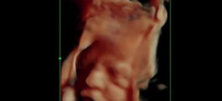 Youtube - 29 haftalık fetusun HD live görüntüsü