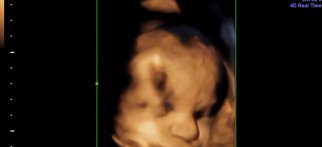 Youtube - 32 haftalık gülümseyen fetüs
