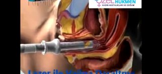 Youtube - Lazer ile vajina daraltma operasyonu