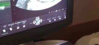 Youtube - Ultrason ve Bebeğin Kalp Atışları