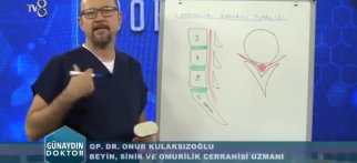 Youtube - Op. Dr. Onur Kulaksızoğlu | Omurilik kanal darlığı | 05.01.2018