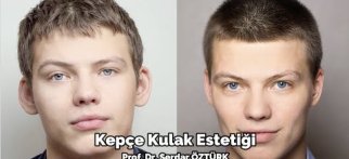 KEPCE KULAK AMELİYATI