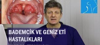 BADEMCİK VE GENİZ ETİ HASTALIKLARI | PROF. DR. TEOMAN DAL