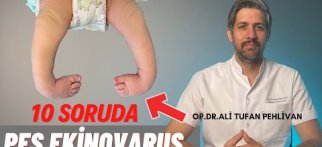 Pes Ekinovarus(PEV, Doğuştan Çarpık Ayak) Nedir? // Pes Ekinovarus, Tedavisi Nasıl Yapılır?