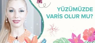 Yüzümüzde varis olur mu?