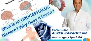 What is HYDROCEPHALUS Disease? Why Does It Occur? | Prof Dr Alper KARAOGLAN