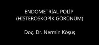 ENDOMETRİAL POLİP (HİSTEROSKOPİK GÖRÜNÜM)