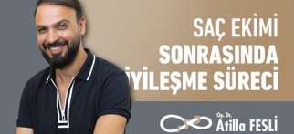 Saç Ekimi Sonrasında İyileşme Süreci Nasıl Oluyor?