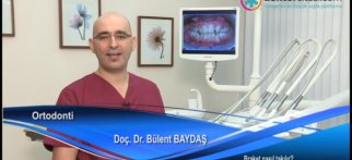 Braket nasıl takılır?